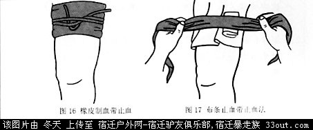69 常用急救知识讲座 (急救小册子)    (1)  橡皮止血带止血法:常用